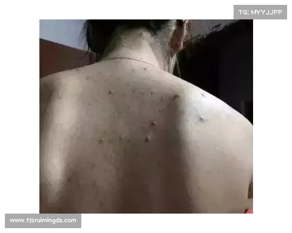 小卢卡斯无缘首发真相揭晓替补背后的五大深层原因分析 小卢卡斯无缘首发真相揭晓替补背后的五大深层原因分析